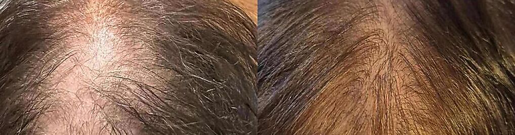 Zdjęcie w galerii New Derm Magdalena Chilewska nr 4