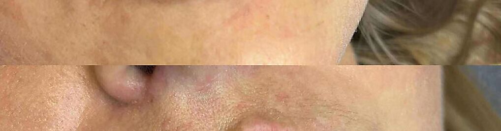 Zdjęcie w galerii New Derm Magdalena Chilewska nr 2