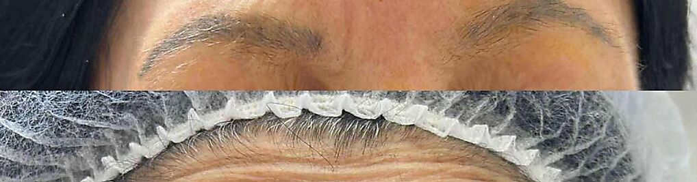 Zdjęcie w galerii New Derm Magdalena Chilewska nr 1